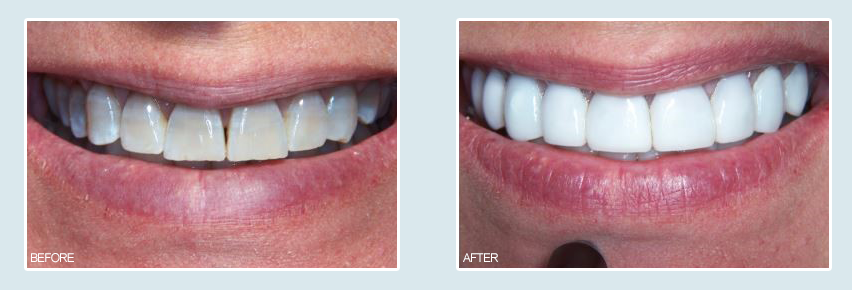 cosmetic dentistry